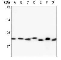 RAB6A Rabbit Polyclonal Antibody