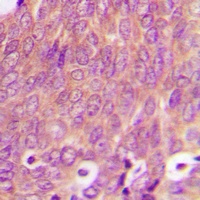 RAB6A Rabbit Polyclonal Antibody