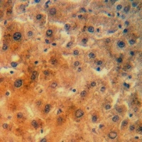 RPS23 Rabbit Polyclonal Antibody