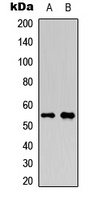 RUNX1 (Phospho-S276) Rabbit Polyclonal Antibody