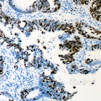 RUNX1 (Phospho-S276) Rabbit Polyclonal Antibody