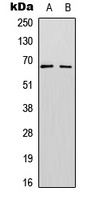 SF1 (Phospho-S82) Rabbit Polyclonal Antibody