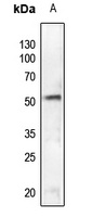 SGK1 (Phospho-S78) Rabbit Polyclonal Antibody