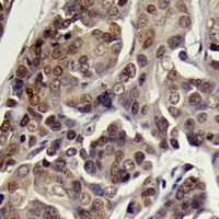 SGK1 (Phospho-S78) Rabbit Polyclonal Antibody