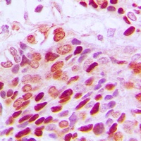 SP1 (Phospho-T739) Rabbit Polyclonal Antibody