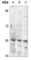 Tyrosine Hydroxylase (Phospho-S19) Rabbit Polyclonal Antibody