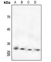 cTnI (Phospho-S22/S23) Rabbit Polyclonal Antibody