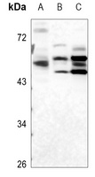 ULK3 Rabbit Polyclonal Antibody