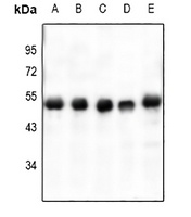 VASP (Phospho-S238) Rabbit Polyclonal Antibody