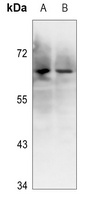 Ku70 (Phospho-S5) Rabbit Polyclonal Antibody