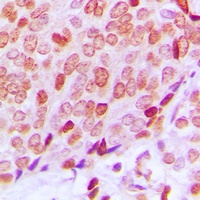 Ku70 (Phospho-S5) Rabbit Polyclonal Antibody