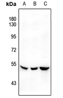 SGK1 (Phospho-S422) Rabbit Polyclonal Antibody