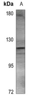 ACLY Antibody