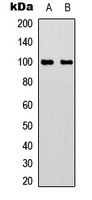 Aconitase 1 (Phospho-S711) Rabbit Polyclonal Antibody