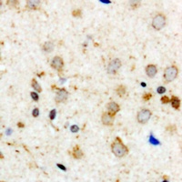 Aconitase 1 (Phospho-S711) Rabbit Polyclonal Antibody