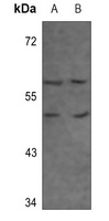 Adenosine A3 Receptor Rabbit Polyclonal Antibody