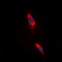Adenosine A3 Receptor Rabbit Polyclonal Antibody