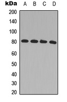 GRK2 Rabbit Polyclonal Antibody