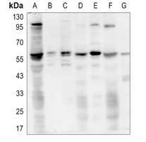 AKT (Phospho-T450) Rabbit Polyclonal Antibody