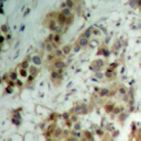 AKT (Phospho-T450) Rabbit Polyclonal Antibody