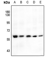 AKT (Phospho-S246) Rabbit Polyclonal Antibody
