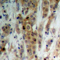 AKT (Phospho-S246) Rabbit Polyclonal Antibody