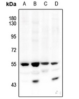 AKT1/2 (Phospho-T308/309) Rabbit Polyclonal Antibody