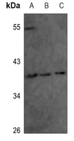 Annexin A1 (Phospho-Y21) Rabbit Polyclonal Antibody