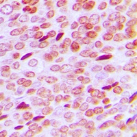 Androgen Receptor (Phospho-S213) Rabbit Polyclonal Antibody