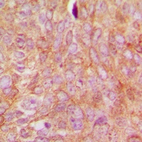 RhoGDI alpha (Phospho-S174) Rabbit Polyclonal Antibody