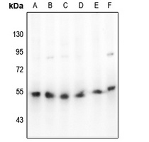 Beta-arrestin-1 Rabbit Polyclonal Antibody