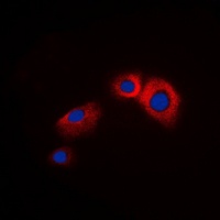 Beta-arrestin-1 Rabbit Polyclonal Antibody