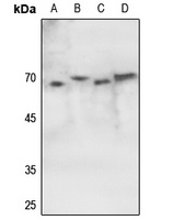 ATF2 (Phospho-S62) Rabbit Polyclonal Antibody