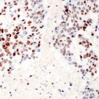ATF2 (Phospho-S62) Rabbit Polyclonal Antibody