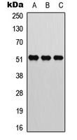 ATF2 (Phospho-T73) Rabbit Polyclonal Antibody