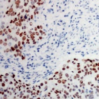 ATF2 (Phospho-T73) Rabbit Polyclonal Antibody