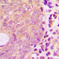 ATP7B Rabbit Polyclonal Antibody