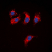 ATP7B Rabbit Polyclonal Antibody