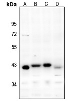 Aurora B Antibody