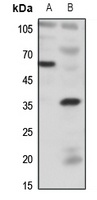 BDKRB1 Rabbit Polyclonal Antibody