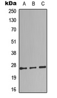 Complement C1QB Rabbit Polyclonal Antibody