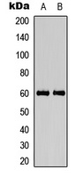 CaMK4 (Phospho-T200) Rabbit Polyclonal Antibody