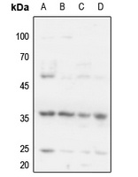 Cyclin H (Phospho-T315) Rabbit Polyclonal Antibody