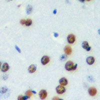 CDCA4 Rabbit Polyclonal Antibody