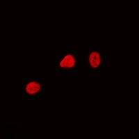CDCA4 Rabbit Polyclonal Antibody