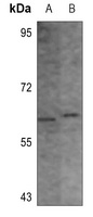 CHK1 (Phospho-S296) Rabbit Polyclonal Antibody