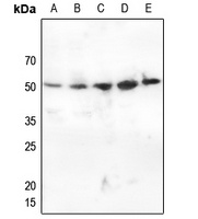 CHK1 (Phospho-S345) Rabbit Polyclonal Antibody