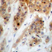 CHK1 (Phospho-S345) Rabbit Polyclonal Antibody