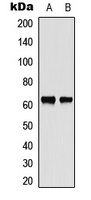 CHK2 Rabbit Polyclonal Antibody