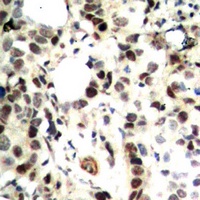 CHK2 Rabbit Polyclonal Antibody